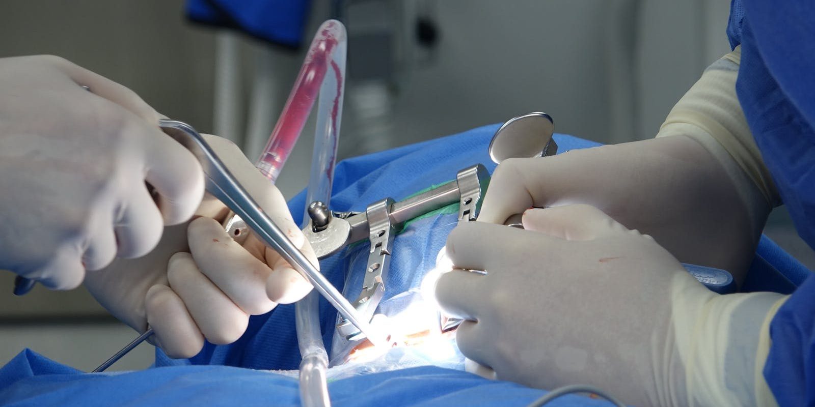Surgeons in an operating room performing spinal surgery with precise tools and sterile equipment.